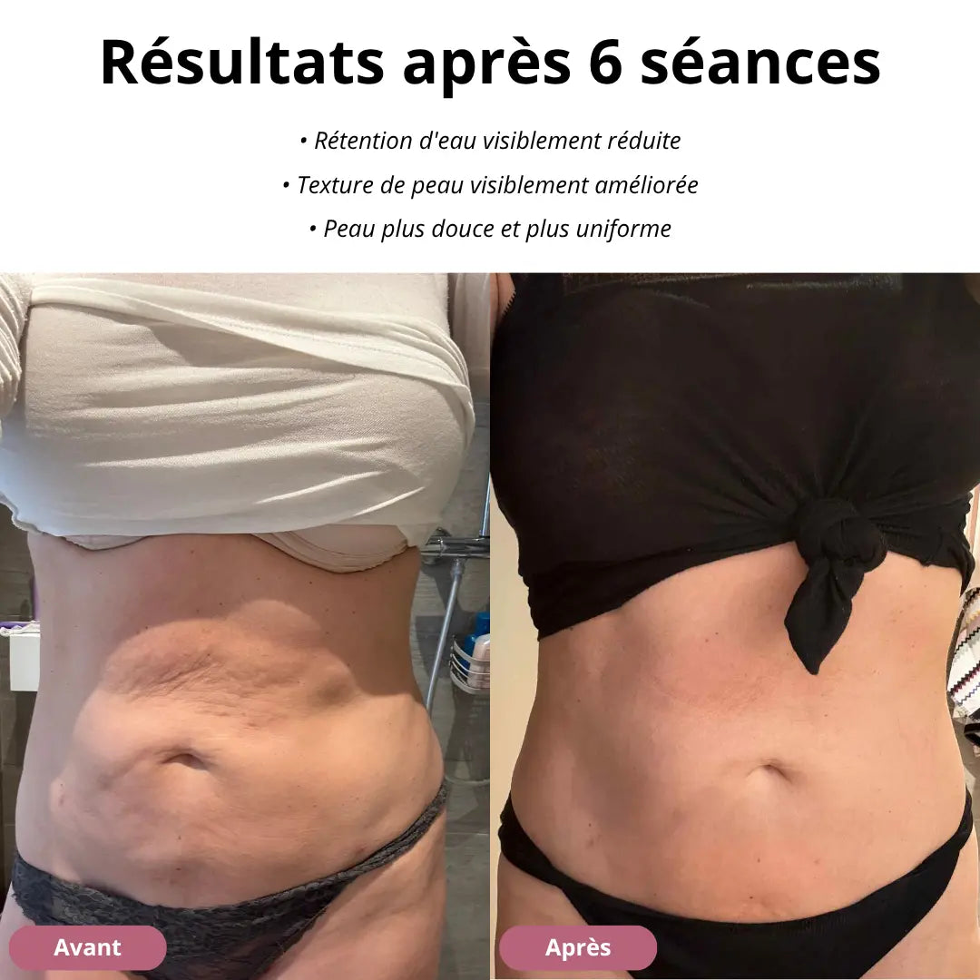 SmoothPulse™ - Appareil de massage
