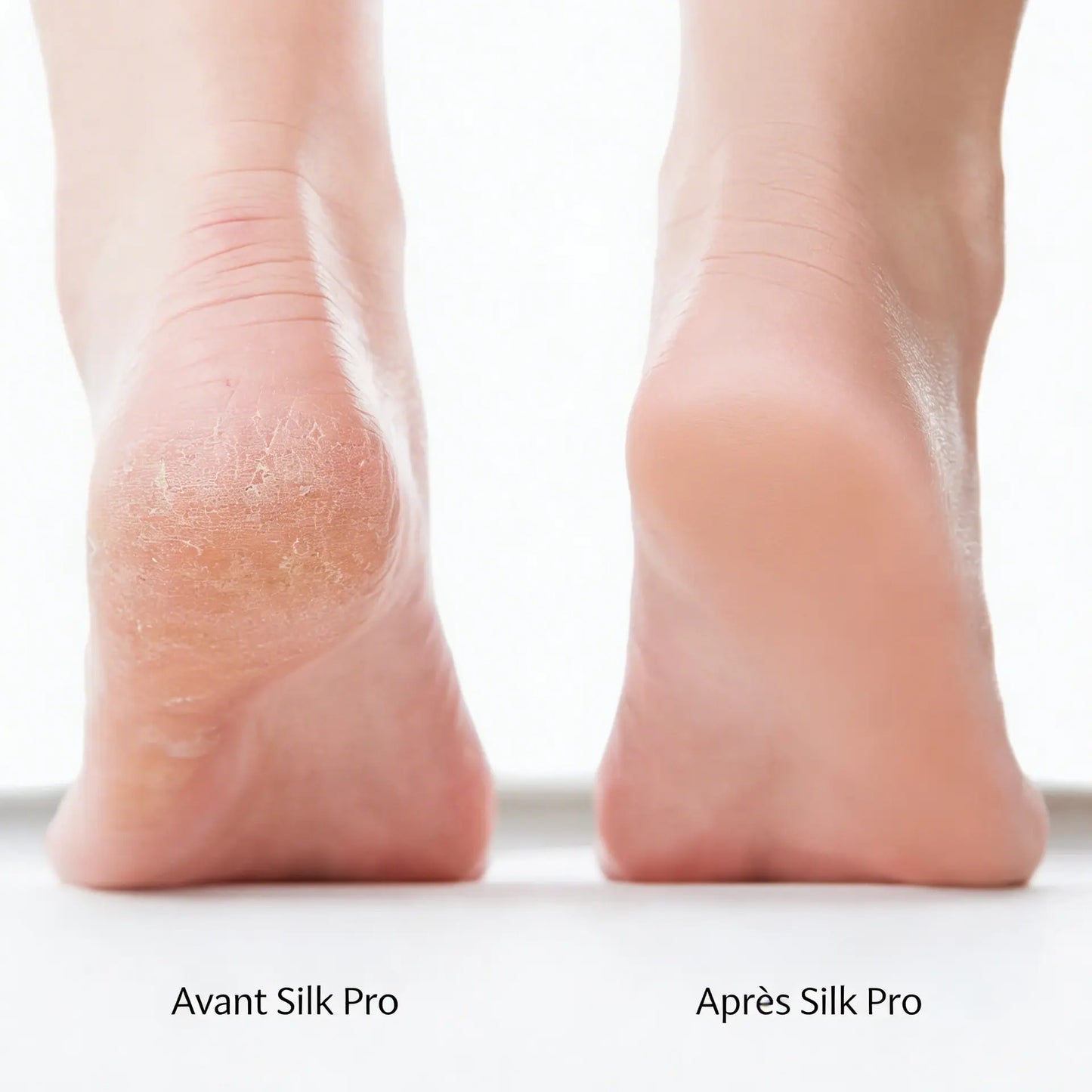 Silk Pro 2 – Des pieds doux sans les frais de salon