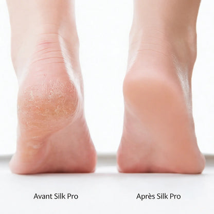 Silk Pro 2 – Des pieds doux sans les frais de salon