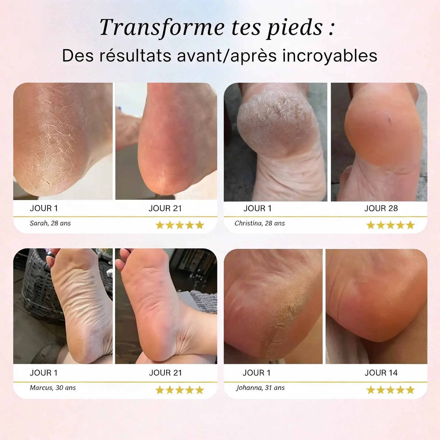 Silk Pro 2 – Des pieds doux sans les frais de salon