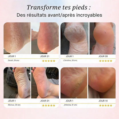 Silk Pro 2 – Des pieds doux sans les frais de salon